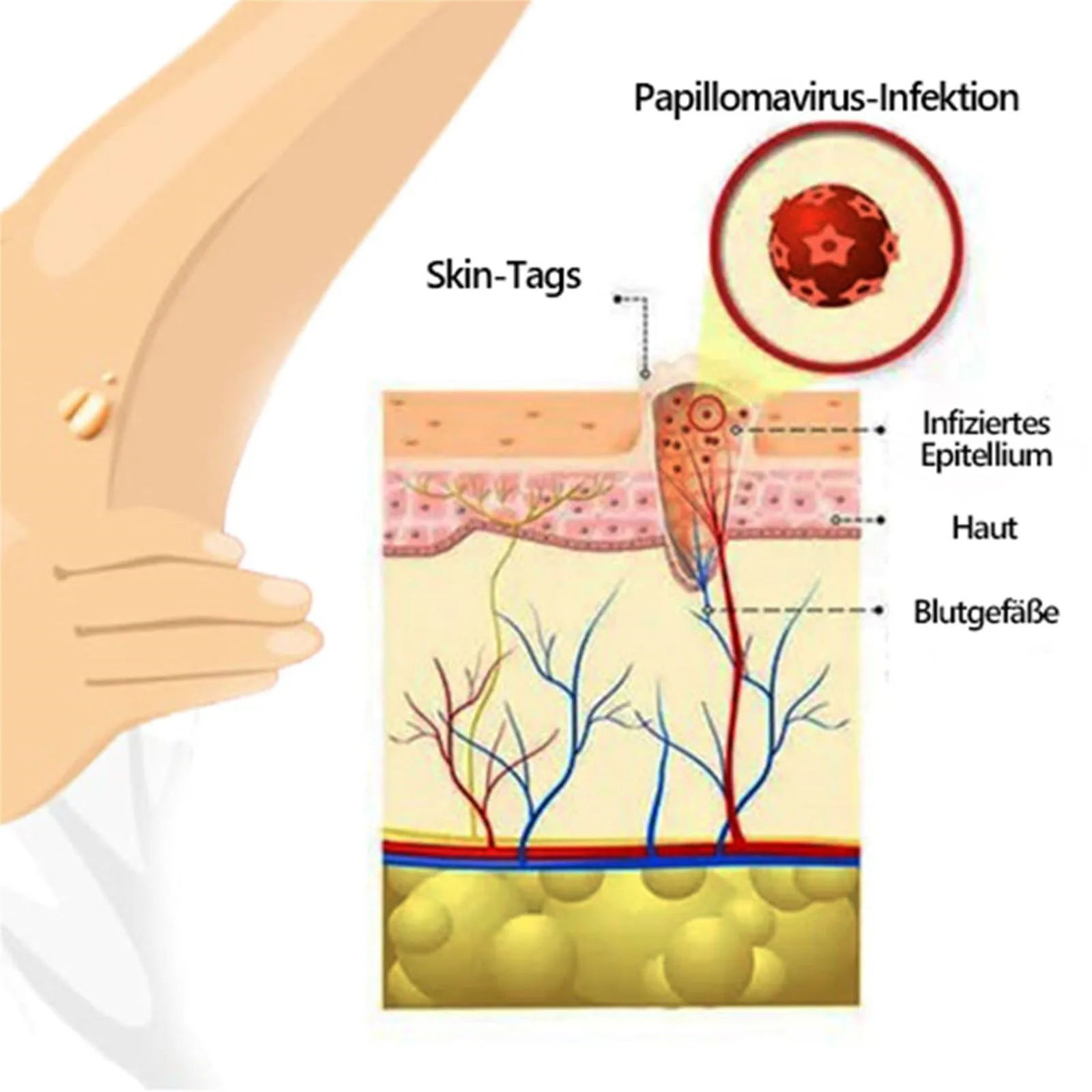 S35cb11b577a246e6ac80c02fa12c6ef1N